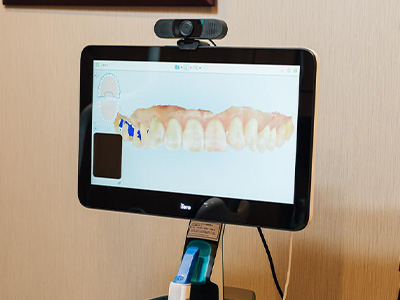 歯科界におけるデジタル化の波　～口腔内スキャナー～