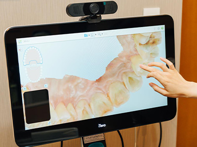 マウスピース矯正～デジタルで実現する精密で負担の少ない矯正治療～