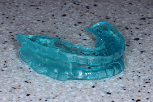 当院で作成できるマウスピースはこの特徴は閉そく性のOSASの軽症から中等症の方に有効です。